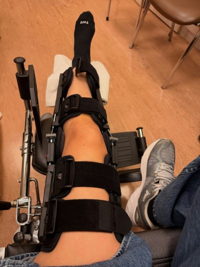 余安安膝骨裂中西针灸三管齐下康复，备战舞台剧兼顾12月澳洲女儿婚礼-硕谷新闻聚合