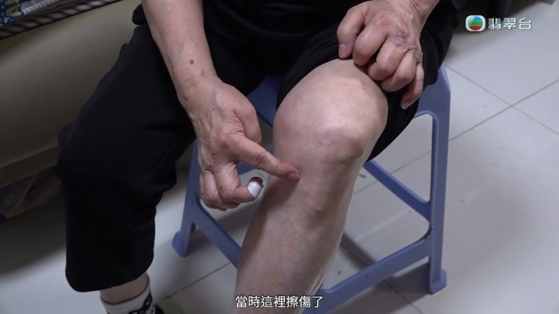 有擦伤。(电视截图)