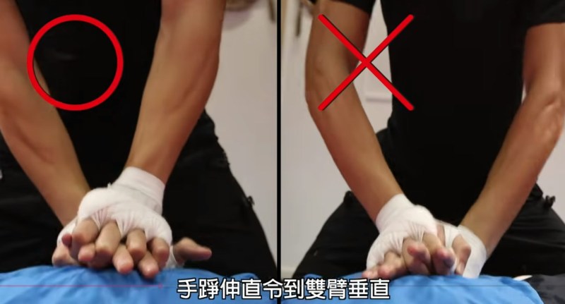 若情况需要则施行心肺复苏法,按压时需紧记「快!狠!准!」的口诀:「快」代表速度为一秒两下;「狠」代表按压深度需达5至6厘米;「准」代表按压位置要准确。